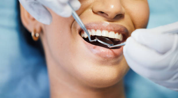 Best Emergency Treatment for Toothache in Monterey, CA