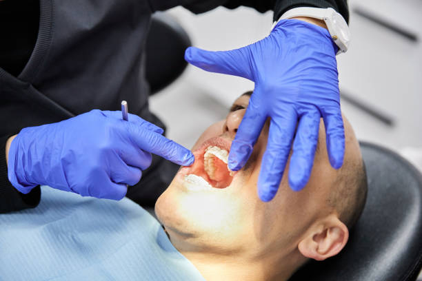 Best Emergency Tooth Extraction in Monterey, CA
