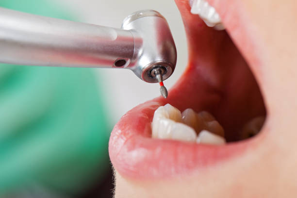 Best Emergency Dental Care for Trauma or Injury in Monterey, CA